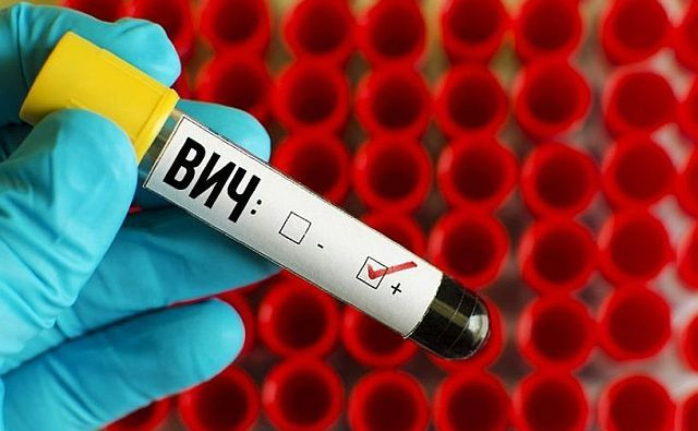 В Ростове выросло число людей, впервые заразившихся ВИЧ