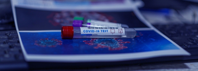 За сутки в Ростовской области от коронавируса умерли 18 человек