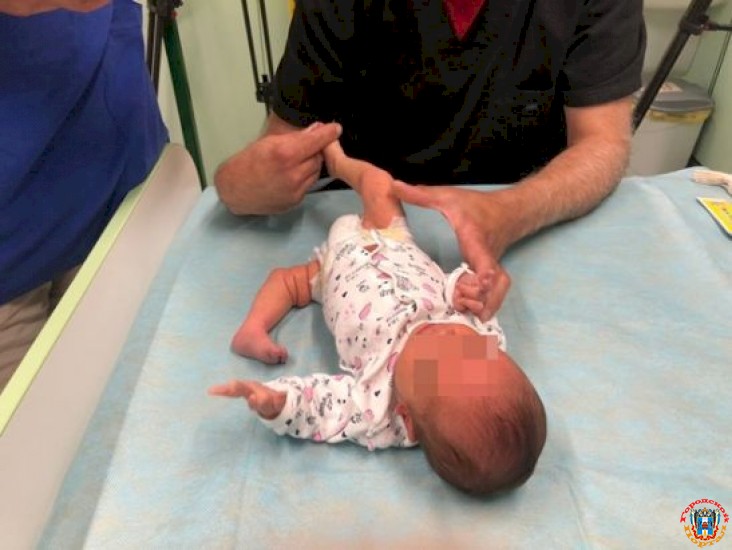 Петербургские врачи спасли младенца из Ростова с врожденным вывихом сустава