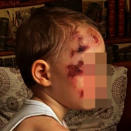 В Ростове парень на электросамокате сбил двухлетнего мальчика