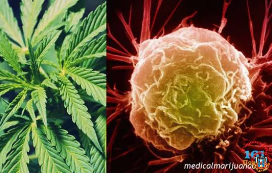 Марихуана укрепляет иммунитет и убивает раковые клетки, выяснили немецкие врачи!
