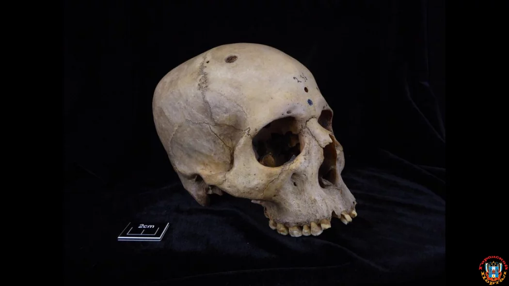 4000-летний египетский череп удивил ученых редкой деталью