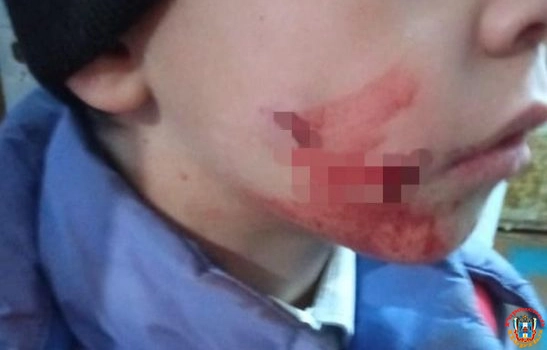 В Ростовской области стая бездомных собак набросилась на школьника