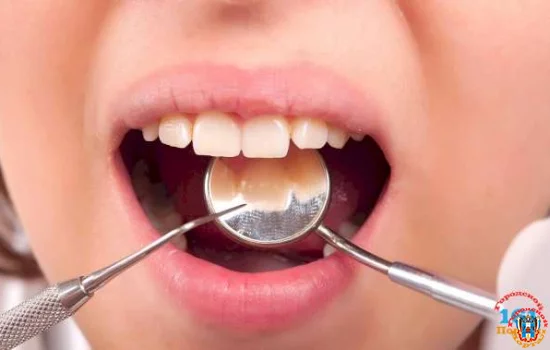 Почему кровоточат десны