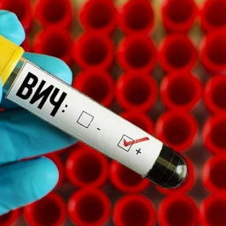 В Ростове выросло число людей, впервые заразившихся ВИЧ