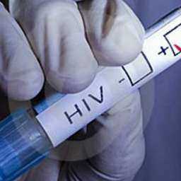 Больные ВИЧ заражают пациентов общих палат в больницах Ростова