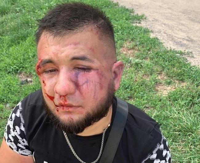 В Ростове избили блогера Гаспара Авакяна