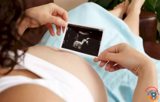 Когда делать УЗИ при беременности