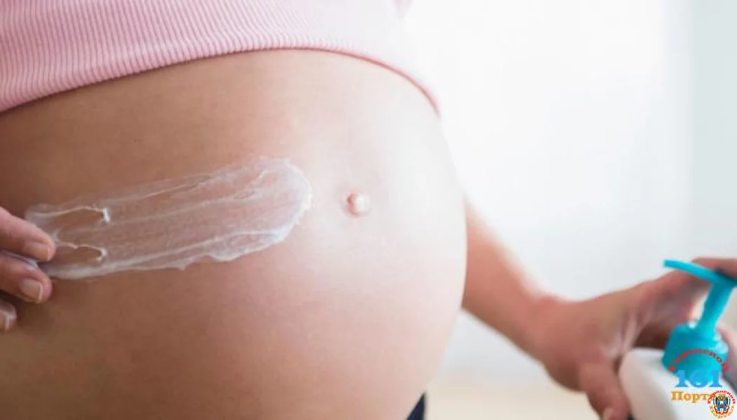 Как избавиться от растяжек во время беременности и после родов