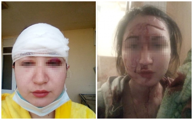 В Ростове отчим жестоко избил девушку, которая вступилась за маму