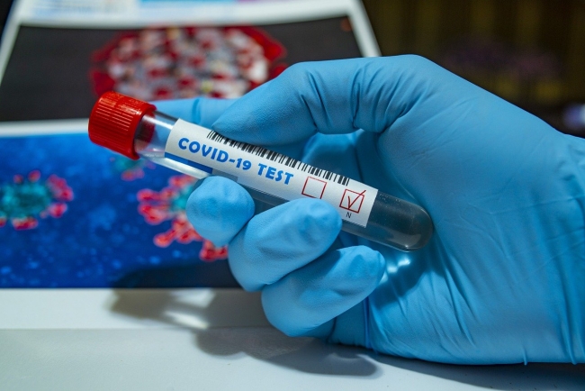 Больше всего новых случаев коронавируса выявлено в Ростове-на-Дону