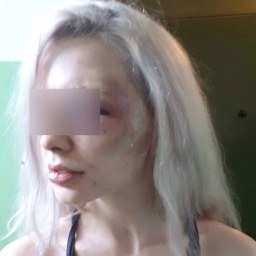 Избивал по лицу камнями и засовывал пальцы в рот: маньяк напал на ростовчанку у автобусной остановки