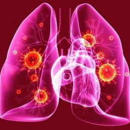 Роспотребнадзор подтвердил вспышку пневмонии в ростовской школе №86