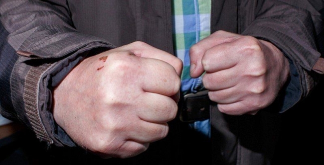 В Ростове пьяный горожанин сломал нос полицейскому