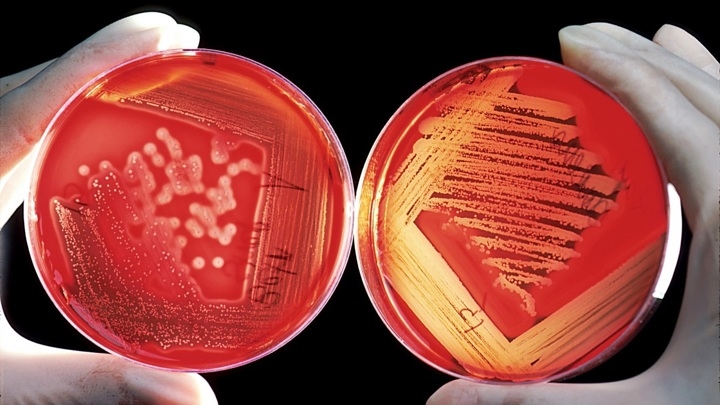 В кишечнике нашли бактерии, влияющие на накопление токсинов в крови