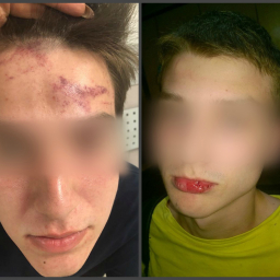 Мажоры на Infiniti с московскими номерами избили ростовских подростков, отмечавших сдачу ЕГЭ